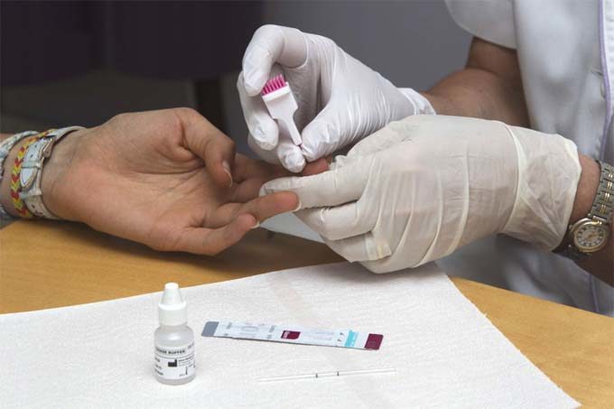 Día mundial del SIDA: testeos gratuitos en el Houssay 